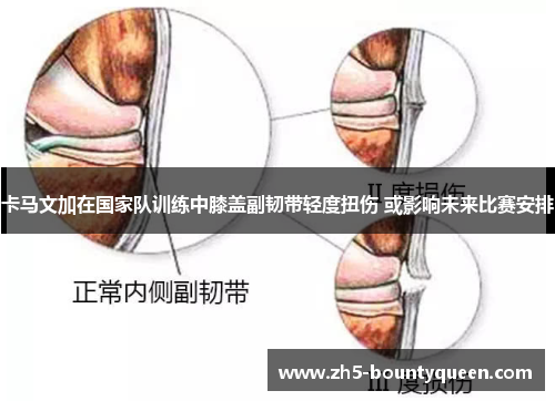 卡马文加在国家队训练中膝盖副韧带轻度扭伤 或影响未来比赛安排